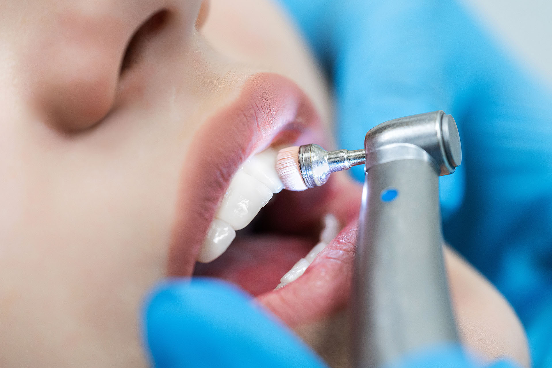 Close-up of teeth with brushing technology in the dentist’s offi